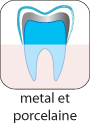 Materiaux pour les couronnes dentaires en Hongrie