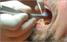 Dentiste en Hongrie et aux Pays bas